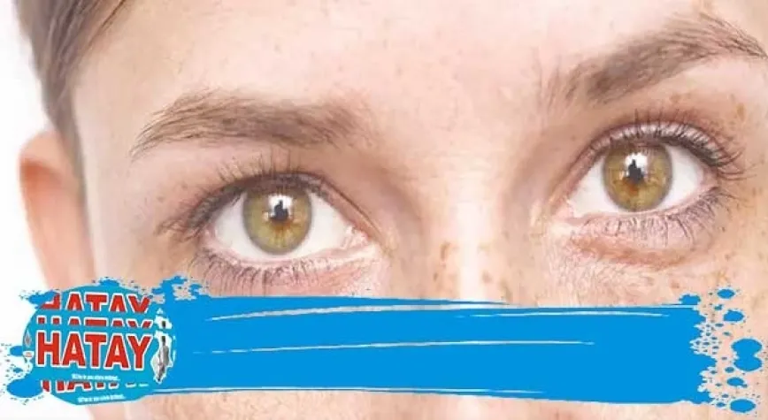 10 Soruda Güneş Lekeleri