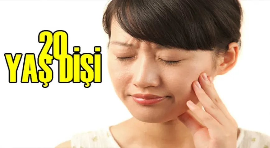 20 YAŞ DİŞLERİ HAKKINDA MERAK EDİLEN NOKTALAR