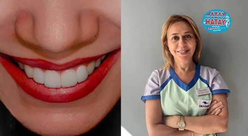 Diş Estetiğinde Günümüz Trendleri Kişiden Kişiye Değişiyor