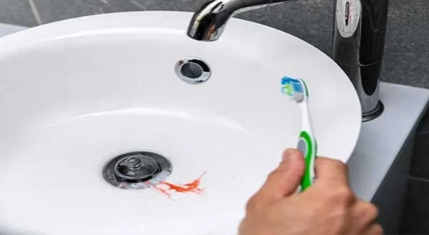 Diş Eti Kanaması Nedir