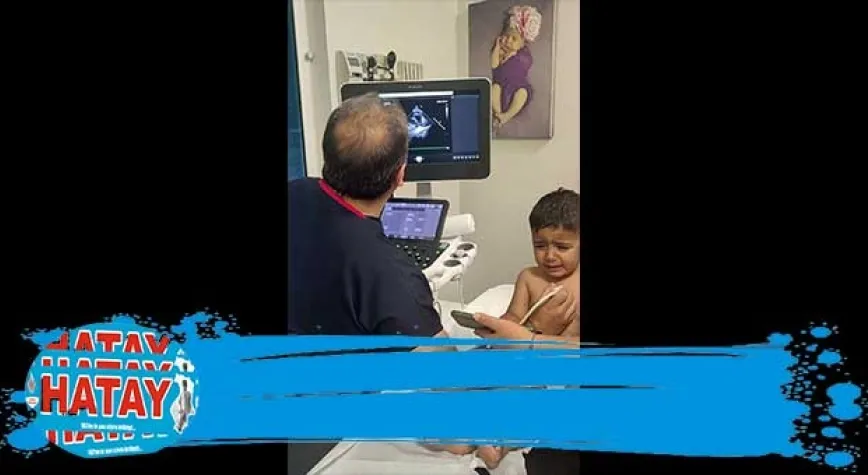 KALBİ DELİK ÇOCUK ANJİYO İLE SAĞLIĞINA KAVUŞTU