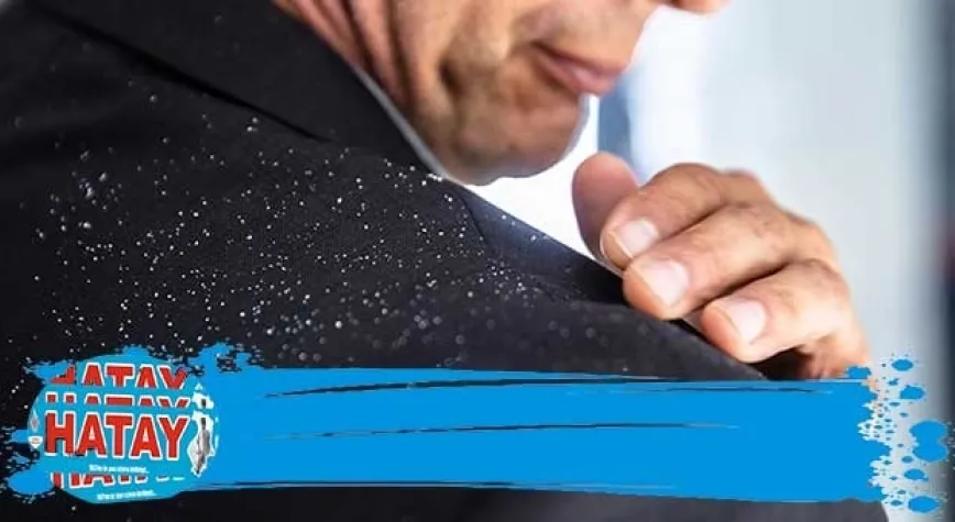 Kepek Neden Olur, Nasıl Geçer?