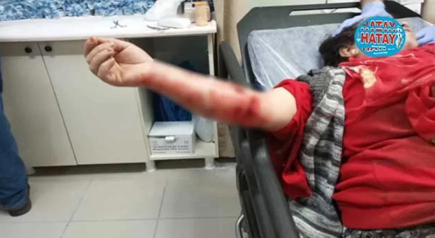 KÖPEĞİN SALDIRDIĞI KADIN HASTANELİK OLDU
