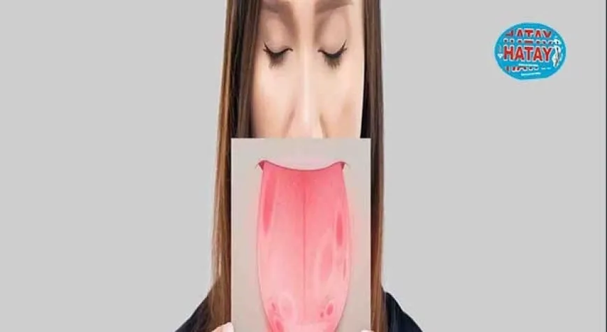 Lökoplaki Nedir?