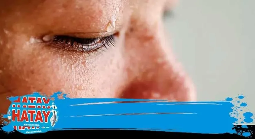 Nemli havalarda cilt bakımı