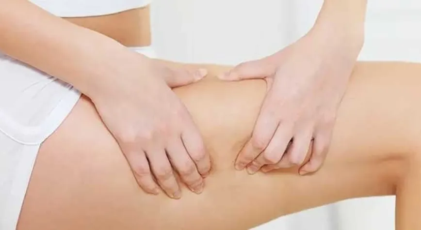 Selülit Neden Olur?