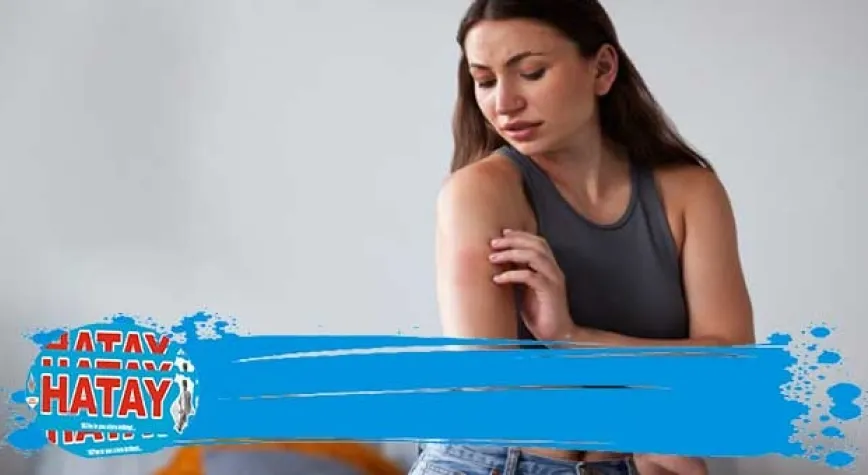 Yanık İzine Ne İyi Gelir?