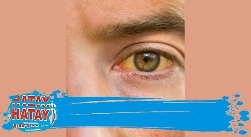 YAZIN GÖZ SAĞLIĞINI KORUMANIN PÜF NOKTALARI 