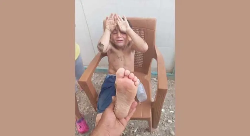 ZAMBUR’ BALIĞI CAN YAKMAYA BAŞLADI